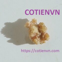 Điều trị chống sỏi thận tại nhà
